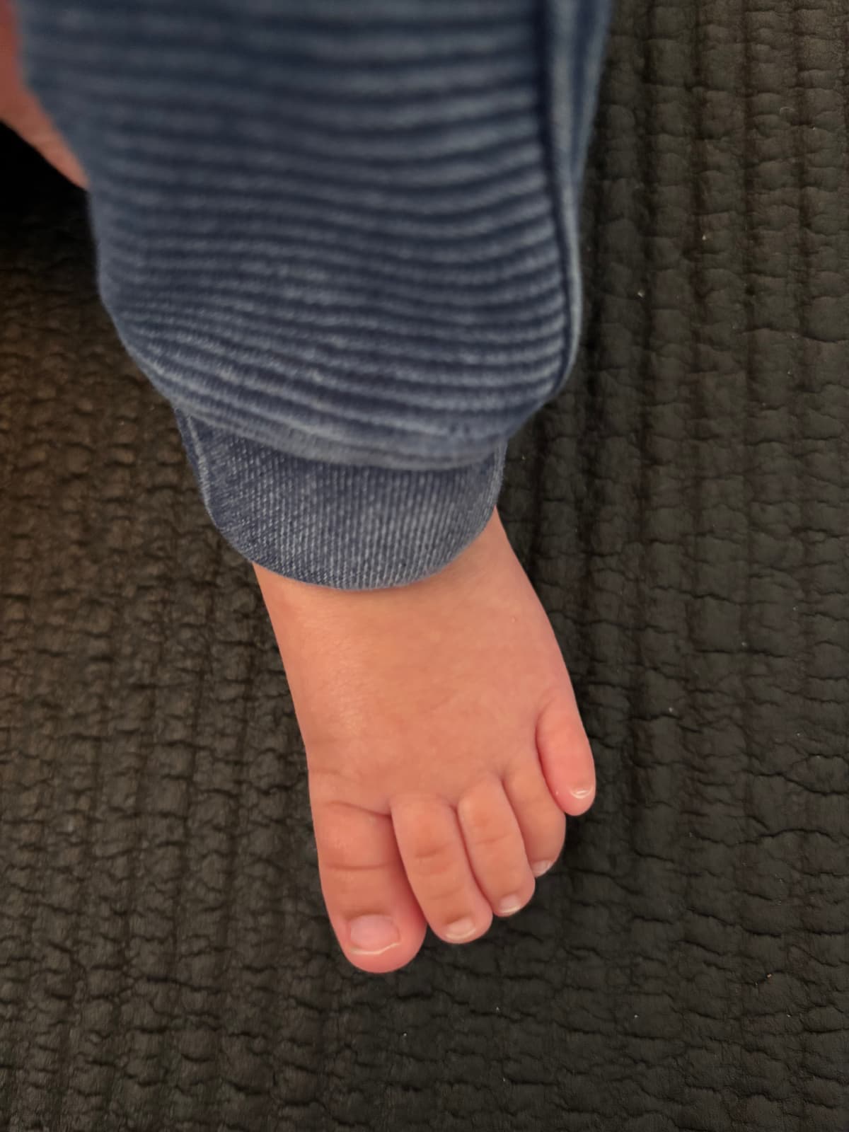 Résultat après un mois de taping